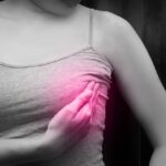 Tehnica ganglionului santinelă – o abordare modernă în tratamentul cancerului mamar