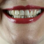 Dinți galbeni? Soluții eficiente pentru albirea naturală